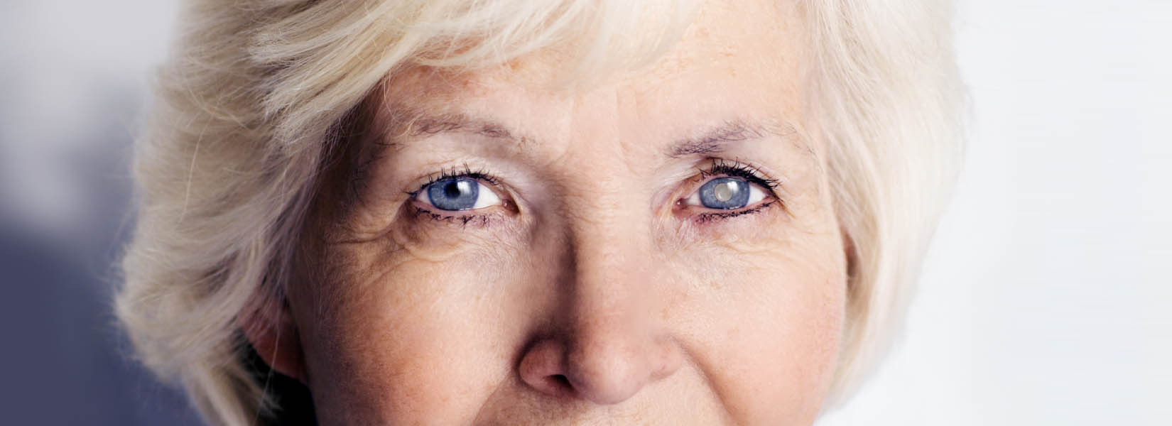 Cataract Surgery in Winter Garden